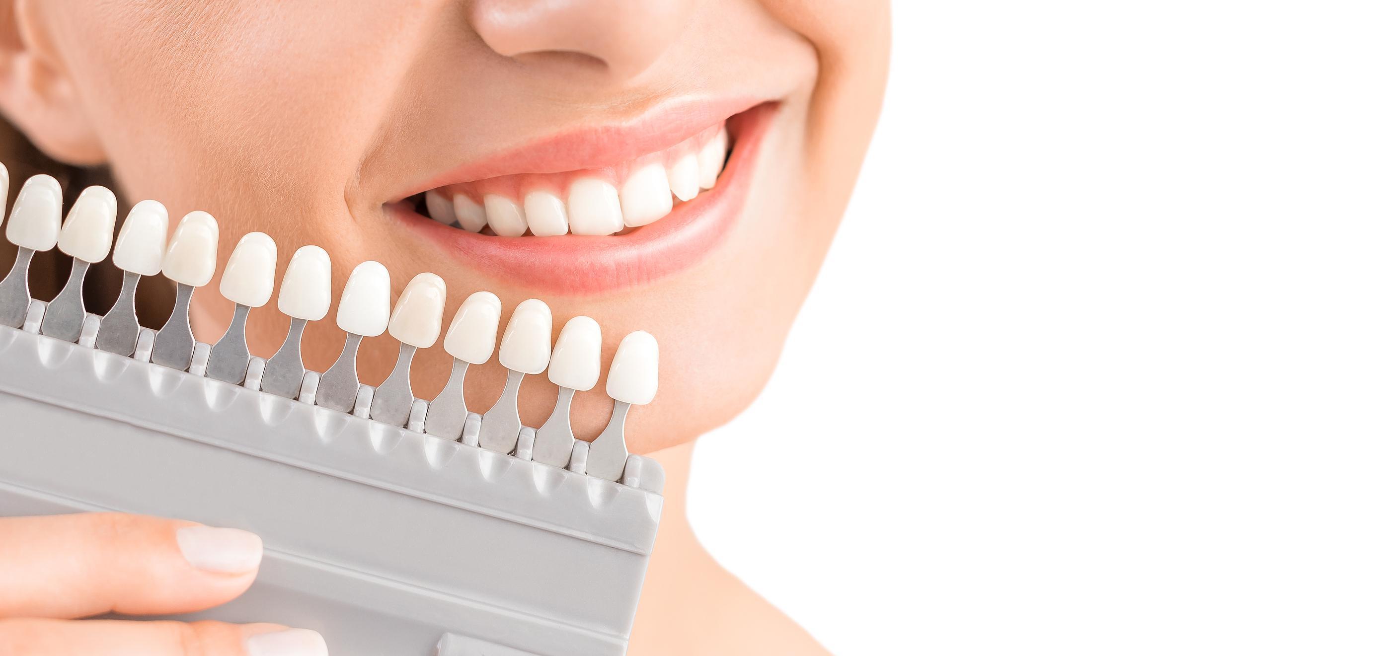 Teeth Whitening San Rafael, CA